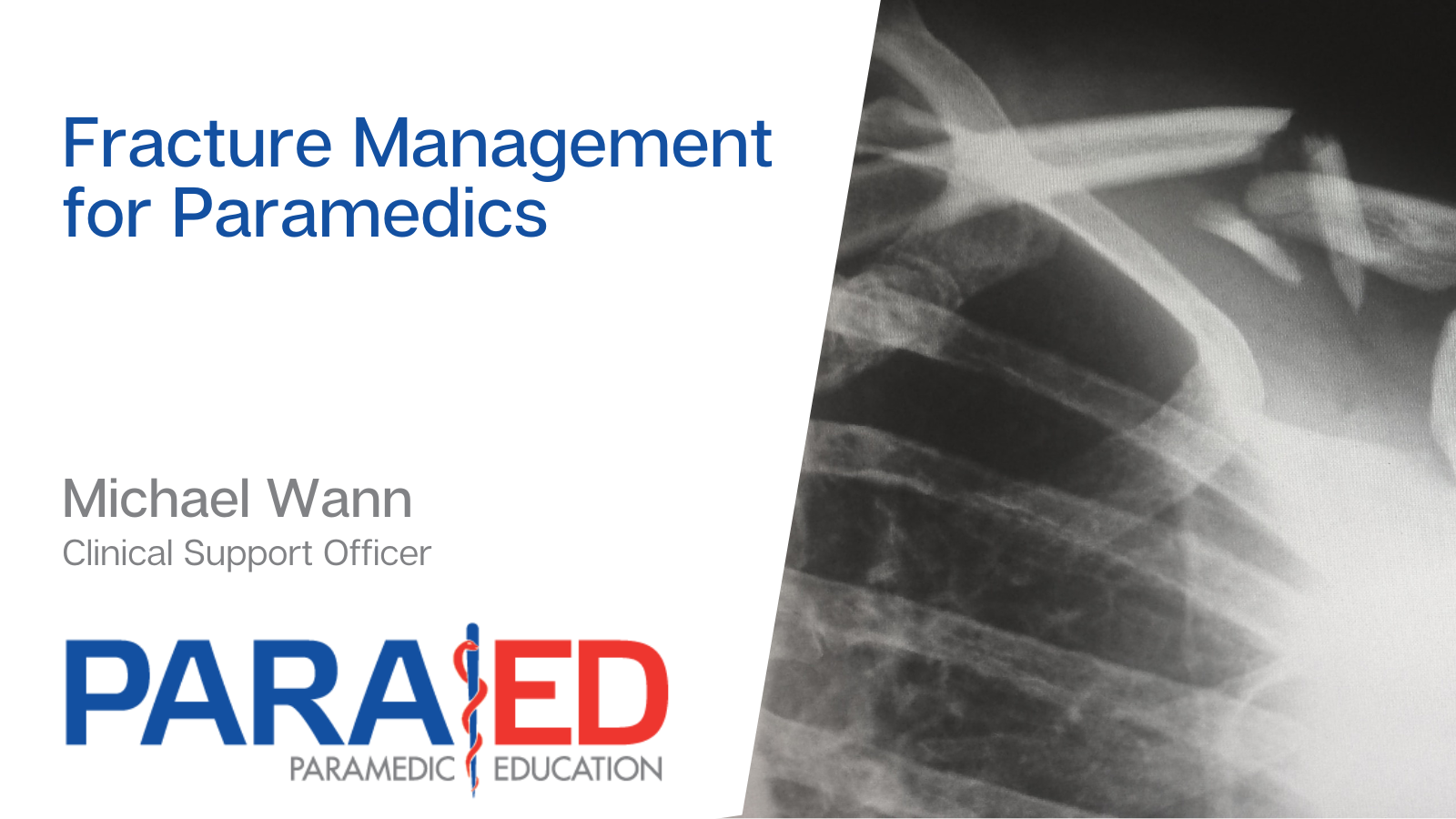 Fracture Management for Paramedics
